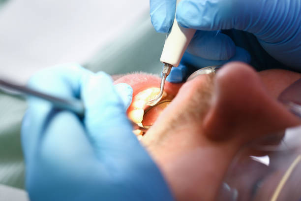 Best Walk-In Emergency Dentist in Barrington, NJ