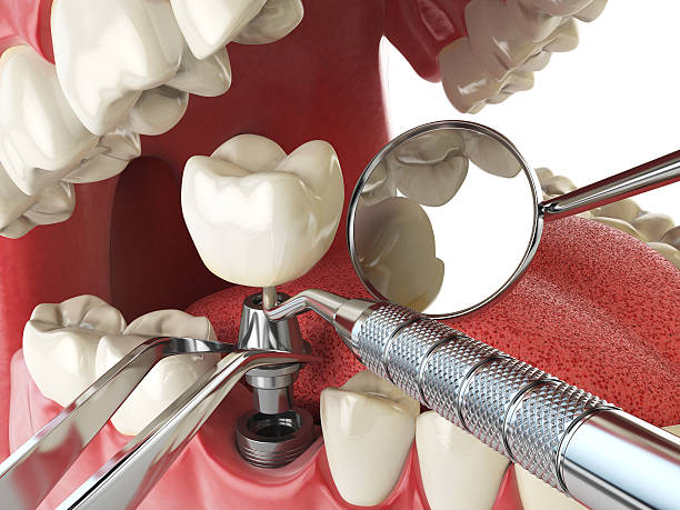 Best Emergency Broken Tooth Repair in Barrington, NJ
